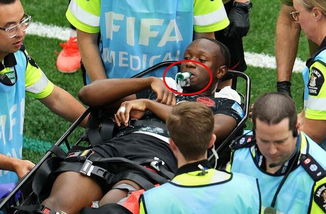 Ayağı kırılan futbolcunun ağzındaki yeşil cismin ne olduğu ortaya çıktı