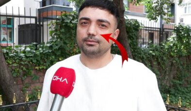 Burun ameliyatına girdi, başına gelmeyen kalmadı! İşini bile kaybetti