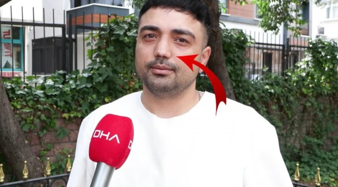 Burun ameliyatına girdi, başına gelmeyen kalmadı! İşini bile kaybetti