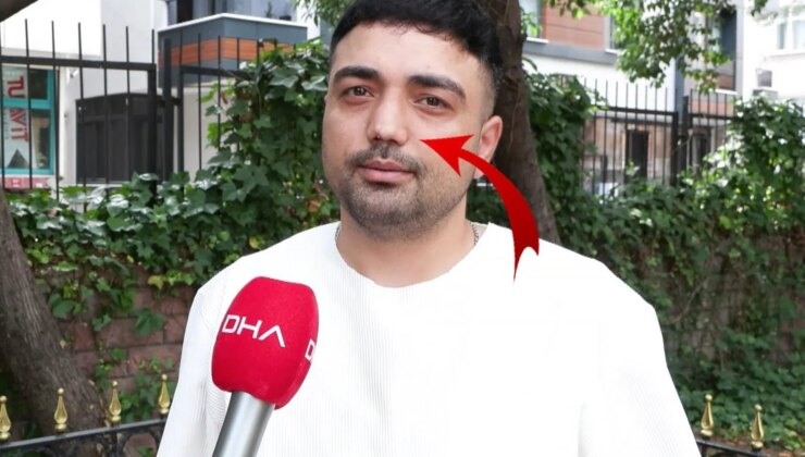 Burun ameliyatına girdi, başına gelmeyen kalmadı! İşini bile kaybetti