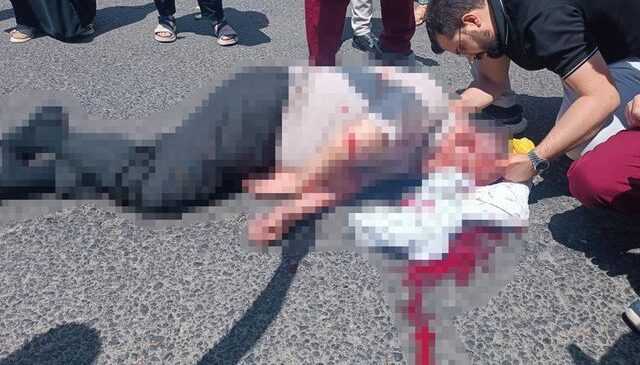 Üniversite kampüsünde korkunç kaza