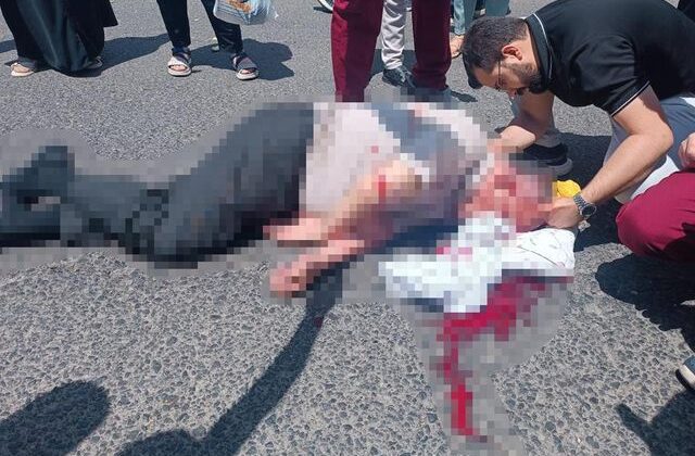 Üniversite kampüsünde korkunç kaza