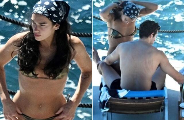 Dua Lipa’nın eşinin sırtındaki izler dikkat çekti