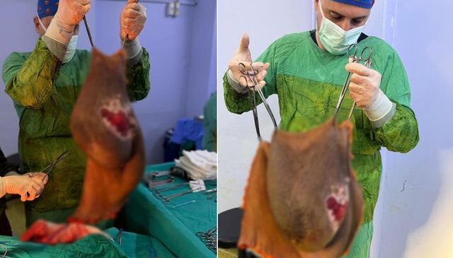 Bu kitle bir insanın karnından çıktı! Doktor tek başına kaldıramadı
