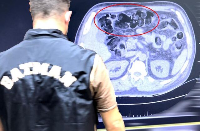Şüpheli hareketleri ele verdi! Midesinden çıkanlar şaşkına çevirdi