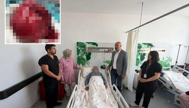 Niğde’de bir hastanın vücudundan 7 kiloluk tümör çıkarıldı