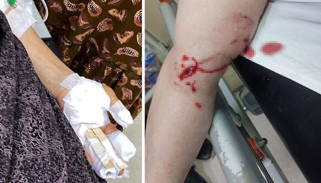 Şırnak’ta sokak köpeği dehşeti: 3 kadın evlerinin önünde kabusu yaşadı