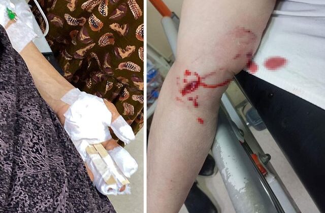 Şırnak’ta sokak köpeği dehşeti: 3 kadın evlerinin önünde kabusu yaşadı
