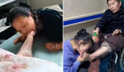 7 yıl boyunca eşinin parmaklarını ısırdı! Doktorların bile beklemediği mucize gerçek oldu