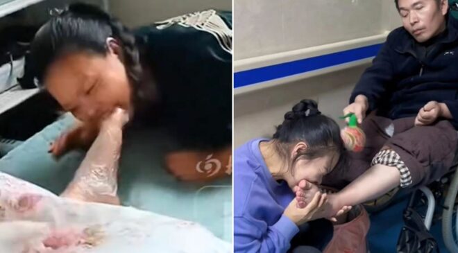 7 yıl boyunca eşinin parmaklarını ısırdı! Doktorların bile beklemediği mucize gerçek oldu