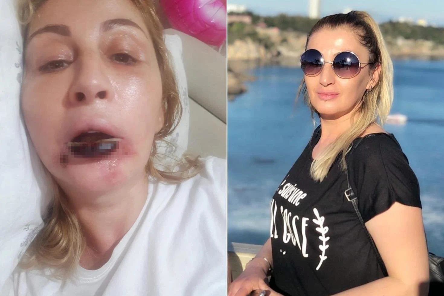guzelleseyim derken bu hale geldi 20020329 90