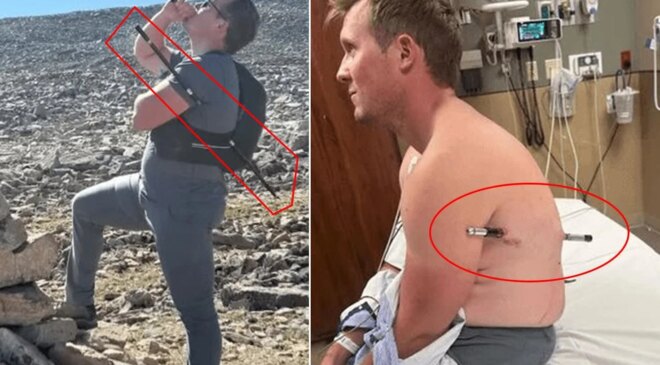Mucize kurtuluş! Bu halde 16 kilometre yürüdü