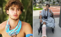 Survivor’da bacağını kaybeden yarışmacıdan yeni paylaşım: Yeni hayatına alışmaya çalışıyor