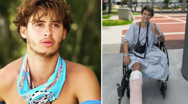 Survivor’da bacağını kaybeden yarışmacıdan yeni paylaşım: Yeni hayatına alışmaya çalışıyor