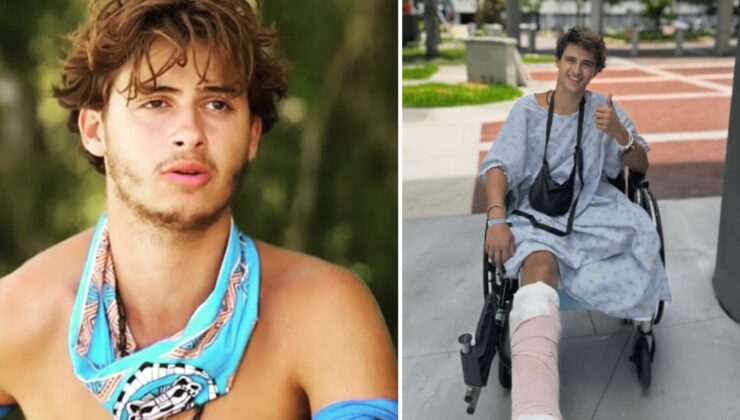 Survivor’da bacağını kaybeden yarışmacıdan yeni paylaşım: Yeni hayatına alışmaya çalışıyor