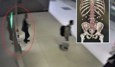İran uyruklu şüphelinin midesinden 380 gram metamfetamin çıktı