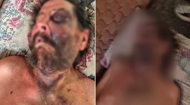 Akılalmaz vahşet! Cenazeye gelmedi diye bu hale getirdi