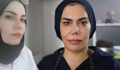 Burun estetiği faciayla sonuçlandı: Kadının hayatı kabusa döndü