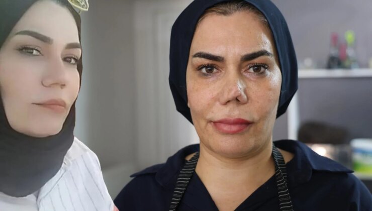 Burun estetiği faciayla sonuçlandı: Kadının hayatı kabusa döndü