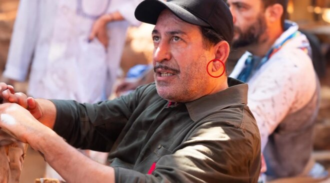 Cem Yılmaz’ın kalp krizi sonrası herkes bu detaya takıldı