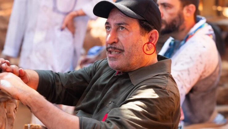 Cem Yılmaz’ın kalp krizi sonrası herkes bu detaya takıldı