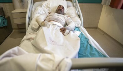 Sigara içerek girdiği evde benzin bidonu parlayınca yardıma gelen eşiyle hastanelik oldu