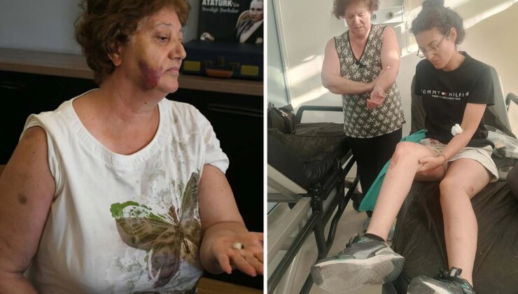 Kuşadası’nda ev işgali dehşeti: Anne, kızı ve oğlu bıçaklandı