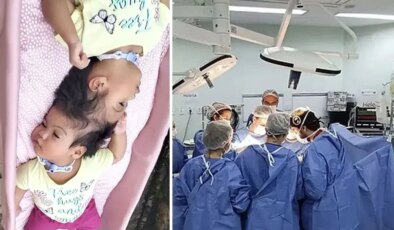 Yapışık ikizlerden acı haber: Kalpleri 14 dakika arayla durdu