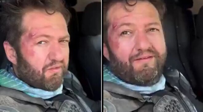 Fenomen Ömer Başdoğan motosiklet kazası geçirdi