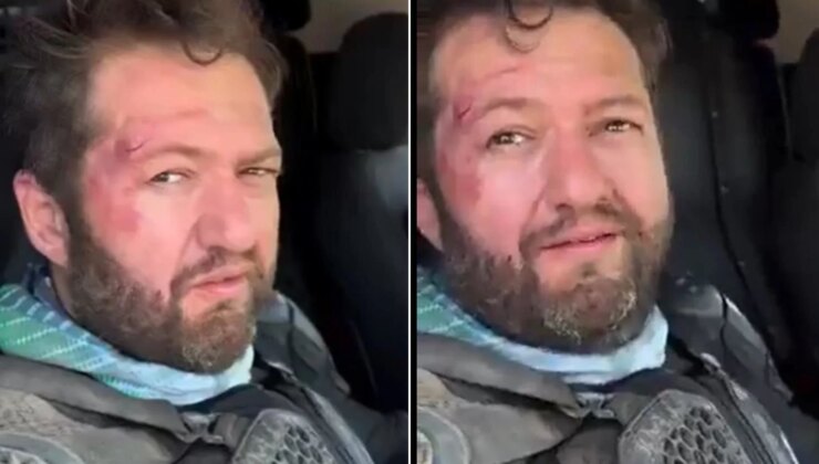 Fenomen Ömer Başdoğan motosiklet kazası geçirdi