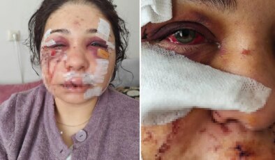 Polis memuru kocasının öldüresiye dövdüğü kadına hapis şoku