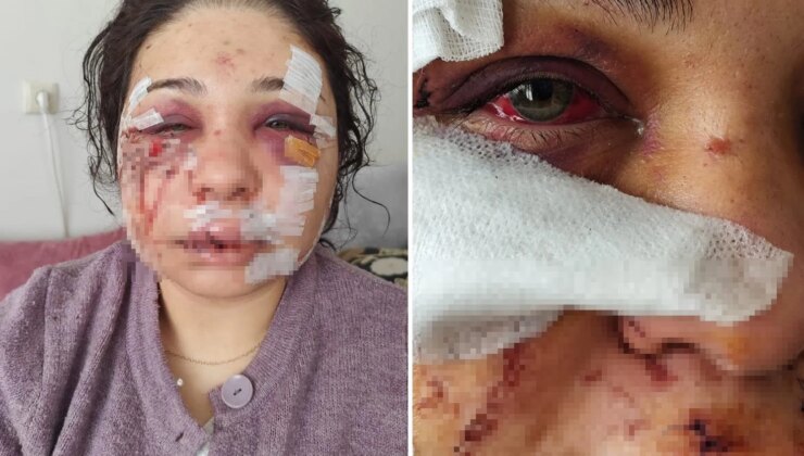 Polis memuru kocasının öldüresiye dövdüğü kadına hapis şoku