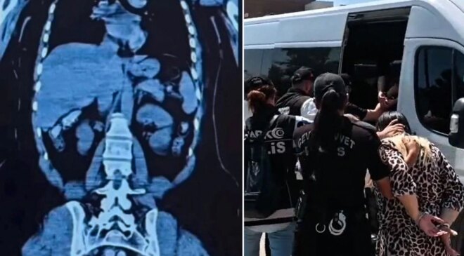 Midelerinde 1,5 kilo uyuşturucu çıkan 2 kadın tutuklandı