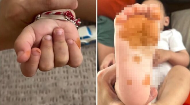 Olay Türkiye’de yaşandı! Sabah uyandığında çocuğunun eline ayağına bakan anne şoke oldu