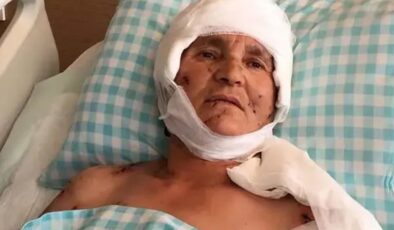 Yaşlı kadın evinin önünde dehşeti yaşadı: Yargıtay’dan köpek saldırısında emsal karar
