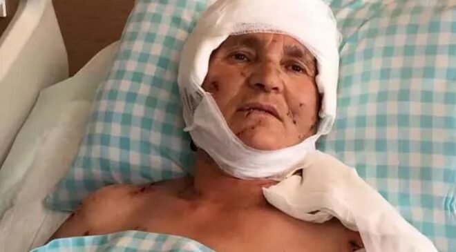 Yaşlı kadın evinin önünde dehşeti yaşadı: Yargıtay’dan köpek saldırısında emsal karar