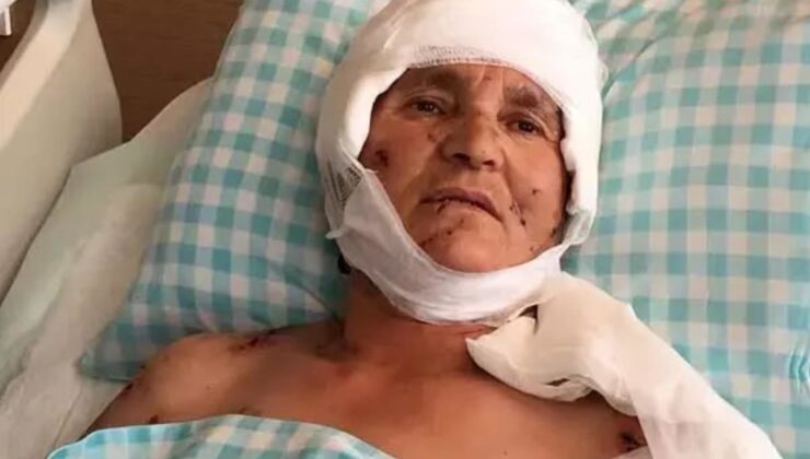 Yaşlı kadın evinin önünde dehşeti yaşadı: Yargıtay’dan köpek saldırısında emsal karar