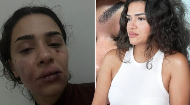 Eski sevgili, uzaklaştırma kararını hiçe sayıp dehşet saçtı! Ebru hemşirenin sesini duyun
