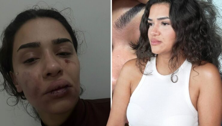 Eski sevgili, uzaklaştırma kararını hiçe sayıp dehşet saçtı! Ebru hemşirenin sesini duyun