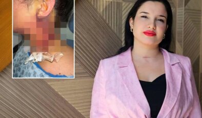 Estetik operasyon sonrası hayatı kabusa döndü
