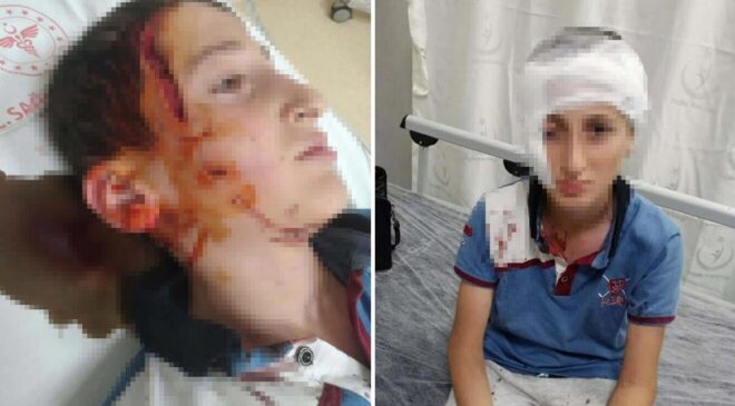 Köpek saldırısında yüzü kalıcı iz kalan çocuk için 1,2 milyon TL tazminat